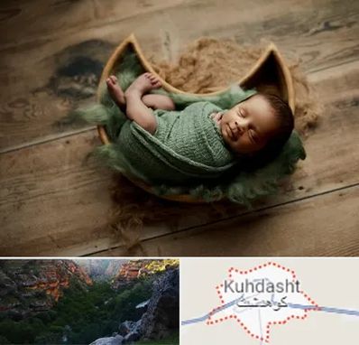 آتلیه نوزاد در کوهدشت