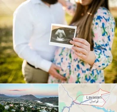 عکاسی بارداری در لواسان