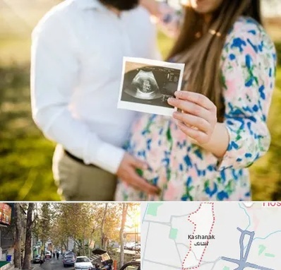 عکاسی بارداری در کاشانک