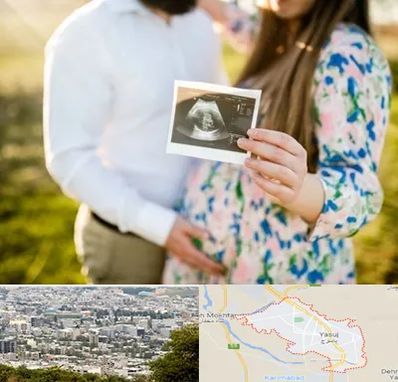 عکاسی بارداری در یاسوج