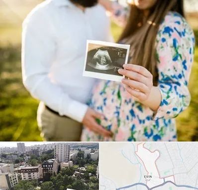 عکاسی بارداری در اوین