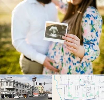 عکاسی بارداری در 17شهریور