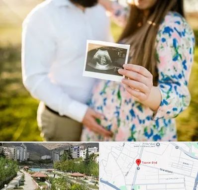 عکاسی بارداری در بلوار تعاون