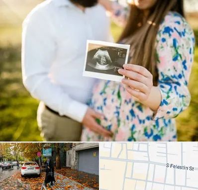 عکاسی بارداری در خیابان فلسطین