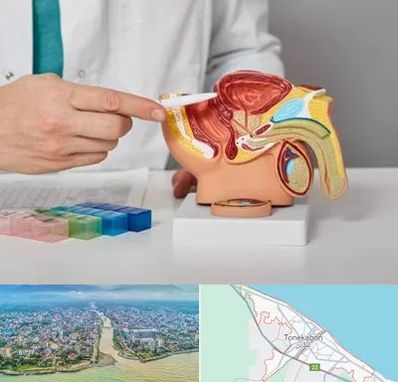 دکتر اورولوژی در تنکابن