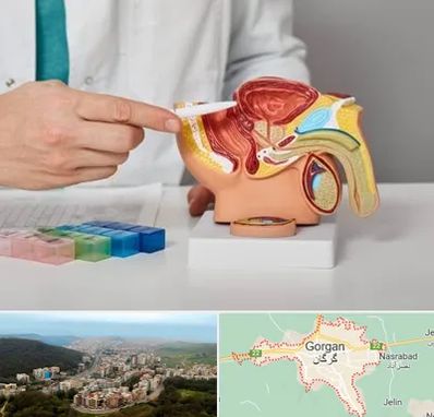 دکتر اورولوژی در گرگان