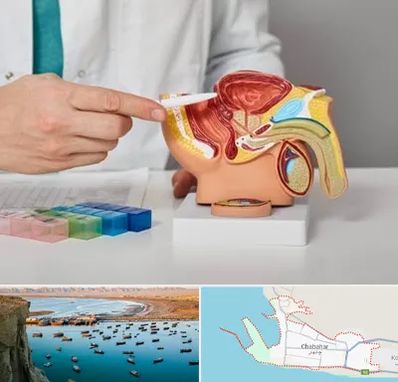 دکتر اورولوژی در چابهار