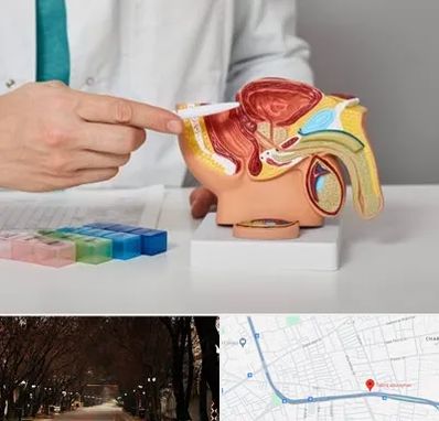 دکتر اورولوژی در ابوریحان تبریز