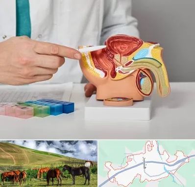 دکتر اورولوژی در تالش