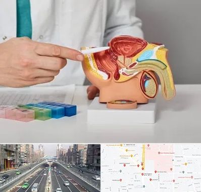 دکتر اورولوژی در توحید 