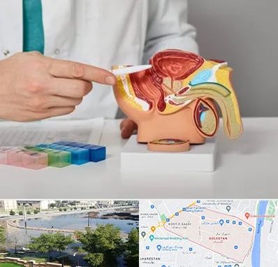 دکتر اورولوژی در گلستان اهواز 