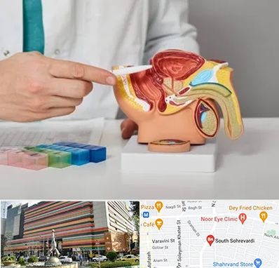 دکتر اورولوژی در سهروردی 