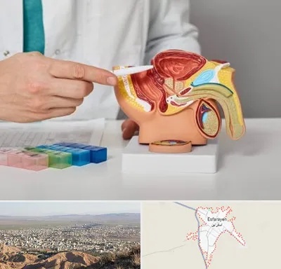 دکتر اورولوژی در اسفراین
