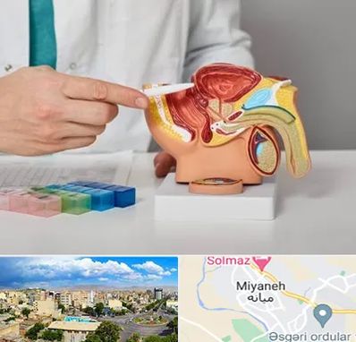 دکتر اورولوژی در میانه