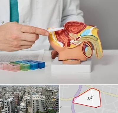 دکتر اورولوژی در آذری