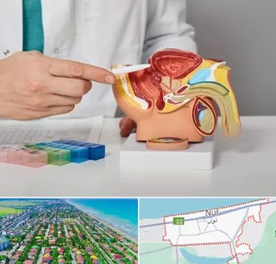 دکتر اورولوژی در نور