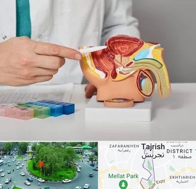 دکتر اورولوژی در تجریش 