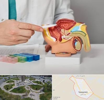 دکتر اورولوژی در ورامین