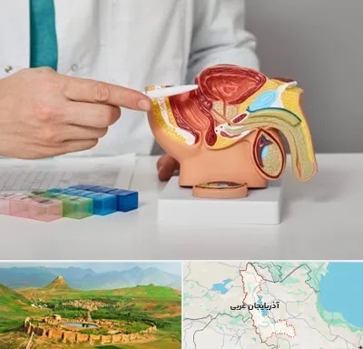 دکتر اورولوژی در آذربایجان غربی