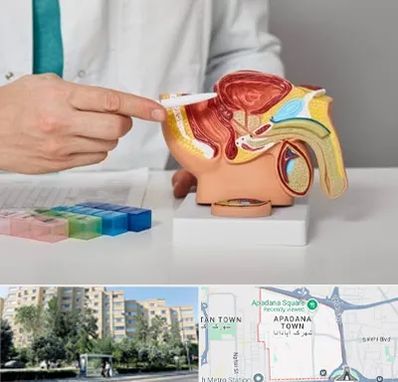 دکتر اورولوژی در آپادانا
