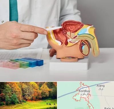 دکتر اورولوژی در کردکوی