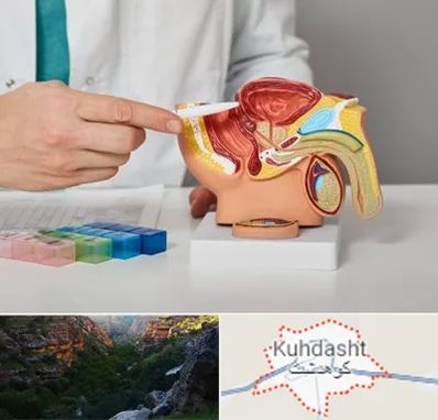 دکتر اورولوژی در کوهدشت