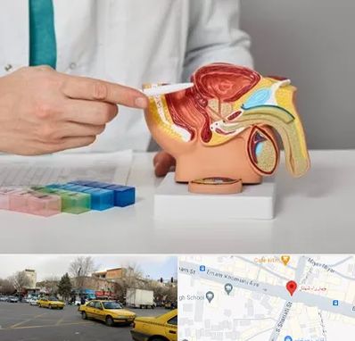 دکتر اورولوژی در شهناز تبریز