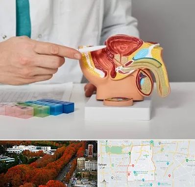 دکتر اورولوژی در منطقه 6 تهران 