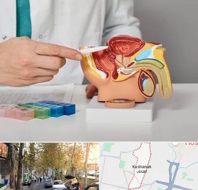 دکتر اورولوژی در کاشانک