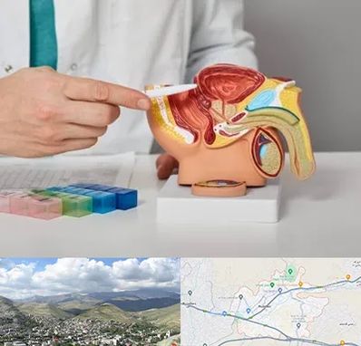دکتر اورولوژی در رودهن