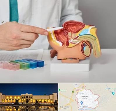 دکتر اورولوژی در برازجان