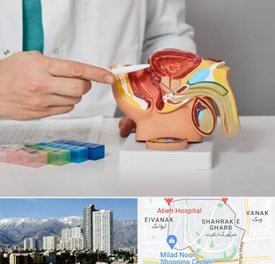 دکتر اورولوژی در شهرک غرب 