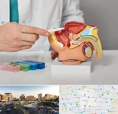 دکتر اورولوژی در منطقه 7 تهران 