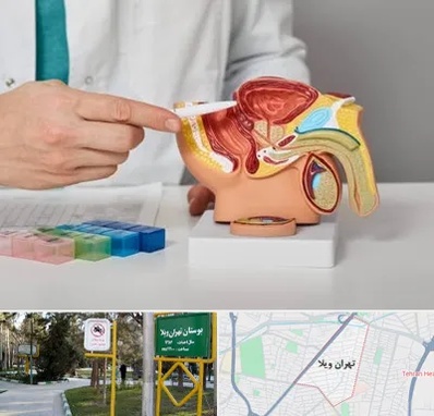 دکتر اورولوژی در تهران ویلا