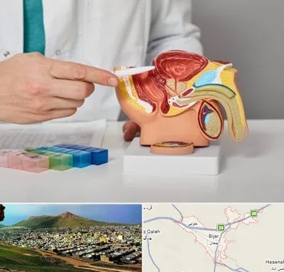 دکتر اورولوژی در بیجار