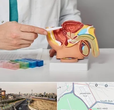 دکتر اورولوژی در جوادیه