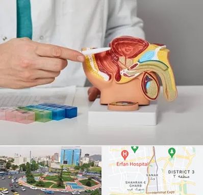 دکتر اورولوژی در ونک 