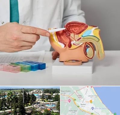 دکتر اورولوژی در رودسر