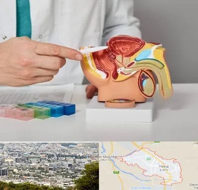 دکتر اورولوژی در یاسوج