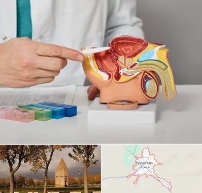 دکتر اورولوژی در تویسرکان