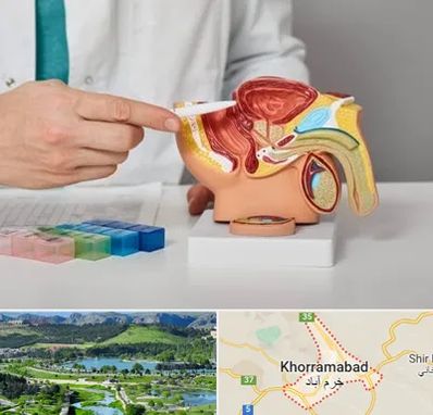 دکتر اورولوژی در خرم آباد