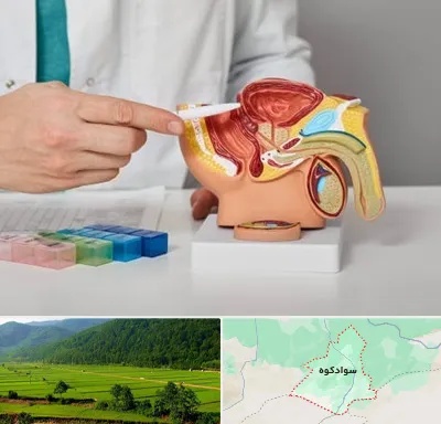 دکتر اورولوژی در سوادکوه