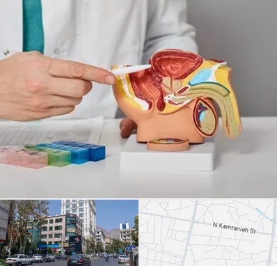 دکتر اورولوژی در کامرانیه