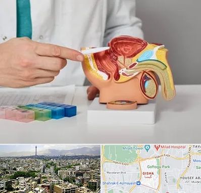 دکتر اورولوژی در گیشا 