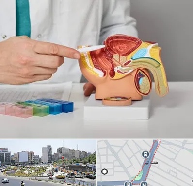 دکتر اورولوژی در هفت تیر