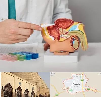 دکتر اورولوژی در ساوه