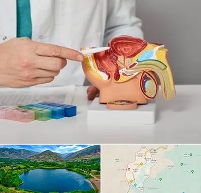 دکتر اورولوژی در رودبار