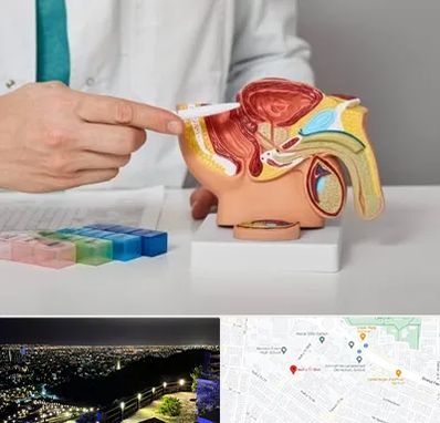 دکتر اورولوژی در هفت تیر مشهد 