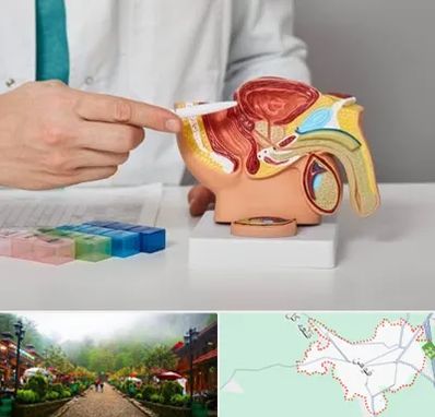 دکتر اورولوژی در فومن