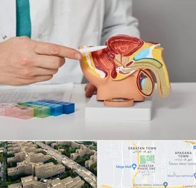 دکتر اورولوژی در اکباتان 